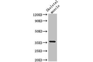 Western Blot Positive WB detected in: Mouse skeletal muscle tissue All lanes: EPM2A antibody at 3 μg/mL Secondary Goat polyclonal to rabbit IgG at 1/50000 dilution Predicted band size: 36, 38, 16, 25, 10, 21, 23 kDa Observed band size: 36 kDa (EPM2A 抗体  (Isoform 9))