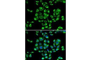 Immunofluorescence analysis of U20S cell using RPS16 antibody. (RPS16 抗体)