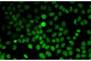 Immunofluorescence analysis of MCF7 cells using ASMT Polyclonal Antibody (ASMT 抗体)