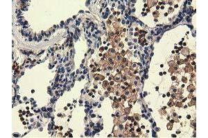 Immunohistochemical staining of paraffin-embedded Human liver tissue using anti-UHMK1 mouse monoclonal antibody. (UHMK1 抗体)