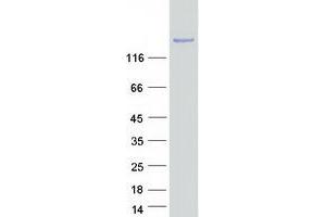 SPAG9 Protein (Transcript Variant 3) (Myc-DYKDDDDK Tag)