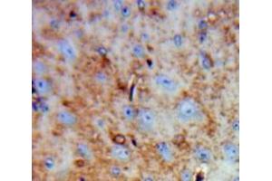 Used in DAB staining on fromalin fixed paraffin-embedded Brain tissue (FAM19A4 抗体  (AA 46-139))