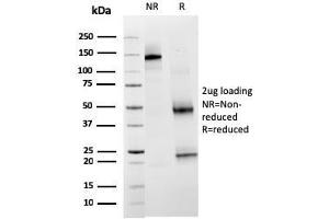 SDS-PAGE Analysis Purified TIM3 Mouse Monoclonal Antibody (TIM3/3113). (TIM3 抗体  (AA 22-202))