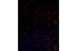 Immunofluorescence analysis of mouse brain using MYCN Rabbit pAb (ABIN1680957, ABIN3015161, ABIN3015163 and ABIN6213865) at dilution of 1:50 (40x lens). (MYCN 抗体  (AA 168-267))