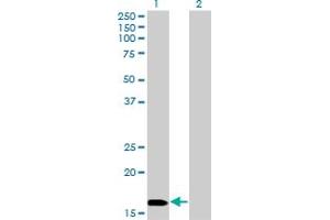 Western Blot analysis of NME3 expression in transfected 293T cell line by NME3 monoclonal antibody (M13), clone 3G10. (NME3 抗体  (AA 73-169))