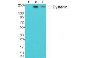 Western blot analysis of extracts from JK cells (Lane 2) and K562 cells (Lane 3), using Dysferlin antiobdy. (Dysferlin 抗体)