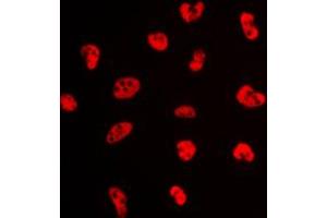 Immunofluorescent analysis of NFYA staining in K562 cells. (NFYA 抗体  (C-Term))