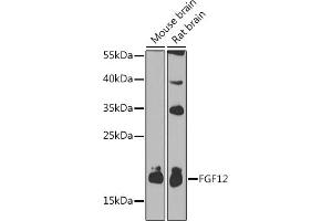 Western blot analysis of extracts of various cell lines, using FGF12 antibody (ABIN3016419, ABIN3016420, ABIN1679841 and ABIN6219744) at 1:1000 dilution. (FGF12 抗体  (AA 1-181))