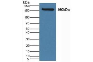 Detection of NCCT in Human Serum using Polyclonal Antibody to Na-Cl Cotransporter (NCCT) (SLC12A3 抗体  (AA 867-1024))