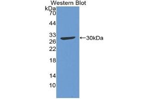 Detection of Recombinant C4, Gallus using Polyclonal Antibody to Complement Component 4 (C4) (Complement C4 抗体  (AA 1428-1660))