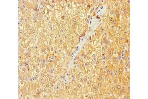 Immunohistochemistry of paraffin-embedded human liver tissue using ABIN7145392 at dilution of 1:100 (B4GALT3 抗体  (AA 34-393))