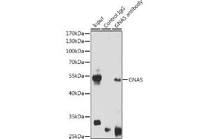 Immunoprecipitation analysis of 200 μg extracts of Mouse brain cells using 3 μg GNAS antibody (ABIN6127959, ABIN6141213, ABIN6141214 and ABIN6221191). (GNAS 抗体  (AA 1-394))