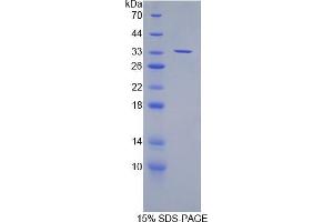 SDS-PAGE analysis of Mouse SUV420H2 Protein. (SUV420H2/KMT5C 蛋白)