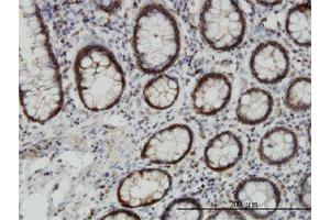 Immunoperoxidase of monoclonal antibody to EPHB3 on formalin-fixed paraffin-embedded human colon. (EPH Receptor B3 抗体  (AA 899-997))