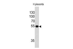 Western Blotting (WB) image for anti-Ornithine Decarboxylase 1 (ODC1) antibody (ABIN6940235)
