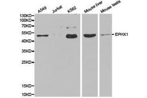 Western Blotting (WB) image for anti-Epoxide Hydrolase 1, Microsomal (Xenobiotic) (EPHX1) antibody (ABIN1872557) (EPHX1 抗体)