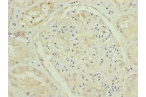 Immunohistochemistry of paraffin-embedded human kidney tissue using ABIN7151254 at dilution of 1:100 (TRIM31 抗体  (AA 186-425))