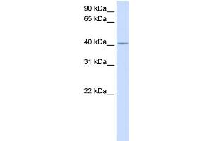 WB Suggested Anti-C2orf18 Antibody Titration:  0. (SLC35F6 抗体  (Middle Region))