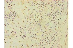 Immunohistochemistry (IHC) image for anti-ATP Synthase, H+ Transporting, Mitochondrial F0 Complex, Subunit F6 (ATP5J) (AA 1-108) antibody (ABIN7144871)