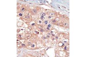 Image no. 2 for anti-U2AF Homology Motif (UHM) Kinase 1 (UHMK1) (N-Term) antibody (ABIN360529) (UHMK1 抗体  (N-Term))