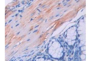 Detection of UCN3 in Mouse Colon Tissue using Polyclonal Antibody to Urocortin 3 (UCN3) (UCN3 抗体  (AA 24-149))