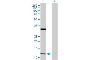 Western Blot analysis of FGF5 expression in transfected 293T cell line by FGF5 MaxPab polyclonal antibody. (FGF5 抗体  (AA 1-123))