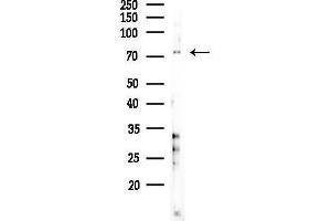 Western blot analysis of lysates from COLO205 cells(heat-shock,45 min treatment), using SLC34 Antibody at 1/1000 dilution. (SLC34A2 抗体  (N-Term))