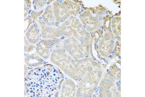 Immunohistochemistry of paraffin-embedded mouse kidney using MYLK antibody at dilution of 1:100 (x40 lens). (MYLK 抗体)
