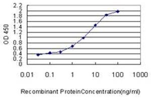 Detection limit for recombinant GST tagged STK38 is approximately 0. (STK38 抗体  (AA 365-465))