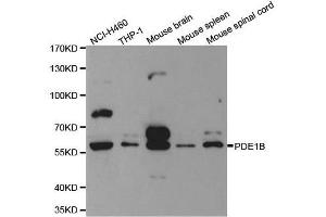 Western blot analysis of extracts of various cell lines, using PDE1B antibody. (PDE1B 抗体  (AA 190-536))
