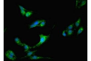 Immunofluorescent analysis of Hela cells using ABIN7148189 at dilution of 1:100 and Alexa Fluor 488-congugated AffiniPure Goat Anti-Rabbit IgG(H+L) (CDSE1 抗体  (AA 433-630))
