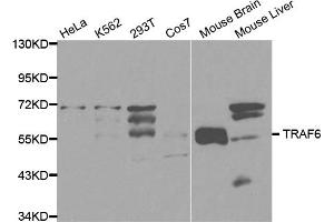 Western blot analysis of extracts of various cell lines, using TRAF6 antibody (ABIN5970361) at 1/1000 dilution. (TRAF6 抗体)