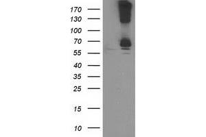 Western Blotting (WB) image for anti-Ribophorin 1 (RPN1) antibody (ABIN1500749) (RPN1 抗体)