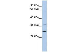 DHRS1 antibody used at 1 ug/ml to detect target protein.
