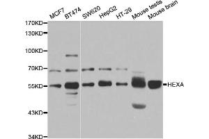Western blot analysis of extracts of various cell lines, using HEXA antibody (ABIN5973292) at 1/1000 dilution. (Hexosaminidase A 抗体)