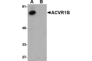 Western Blotting (WB) image for anti-Activin A Receptor, Type IB (ACVR1B) (C-Term) antibody (ABIN1030218) (Activin A Receptor Type IB/ALK-4 抗体  (C-Term))