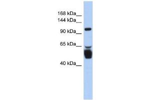 LRRC8B antibody used at 1 ug/ml to detect target protein. (LRRC8B 抗体  (N-Term))