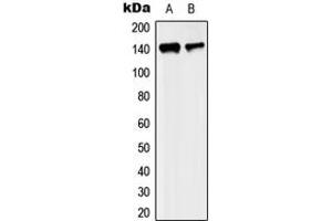 Western blot analysis of KIF4A expression in MCF7 (A), SP2/0 (B) whole cell lysates. (KIF4A 抗体  (C-Term))