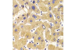 Immunohistochemistry of paraffin-embedded Human liver injury using KIF1B antibody at dilution of 1:100 (x400 lens).