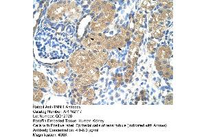 Rabbit Anti-TNNI1 Antibody  Paraffin Embedded Tissue: Human Kidney Cellular Data: Epithelial cells of renal tubule Antibody Concentration: 4. (TNNI1 抗体  (N-Term))