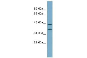 PRKAB1 antibody used at 1 ug/ml to detect target protein. (PRKAB1 抗体  (N-Term))