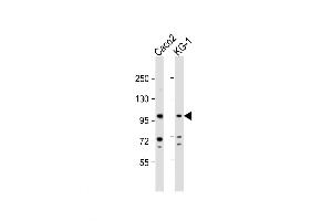Western Blot at 1:1000 dilution Lane 1: Caco2 whole cell lysate Lane 2: KG-1 whole cell lysate Lysates/proteins at 20 ug per lane. (G-CSF 抗体  (AA 252-280))