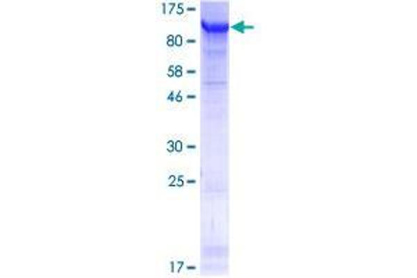 FSIP1 Protein (AA 1-581) (GST tag)