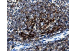 IHC analysis of CD74 using anti-CD74 antibody (ABIN7603166). (CD74 抗体  (N-Term))