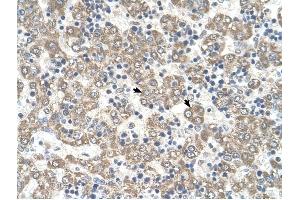 KYNU antibody was used for immunohistochemistry at a concentration of 4-8 ug/ml to stain Hepatocytes (arrows) in Human Liver. (KYNU 抗体)