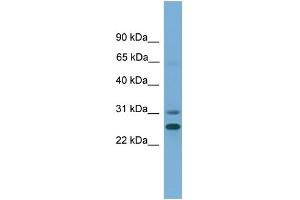 WB Suggested Anti-DHRS2 Antibody Titration:  0. (DHRS2 抗体  (N-Term))