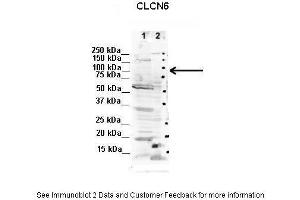 Western Blotting (WB) image for anti-Chloride Channel, Voltage-Sensitive 6 (CLCN6) (C-Term) antibody (ABIN2776242)