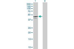Western Blot analysis of SERPINB7 expression in transfected 293T cell line by SERPINB7 MaxPab polyclonal antibody. (SERPINB7 抗体  (AA 1-380))