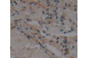 Immunohistochemistry (IHC) image for anti-Fc Fragment of IgA, Receptor For (FCAR) (AA 22-227) antibody (ABIN1867888)