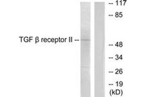 Western Blotting (WB) image for anti-Transforming Growth Factor, beta Receptor II (70/80kDa) (TGFBR2) (AA 91-140) antibody (ABIN2889260) (TGFBR2 抗体  (AA 91-140))